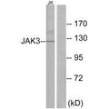 Western blot analysis of extracts from Jurkat cells, using JAK3 (Ab-785) antibody.