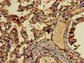 Immunohistochemistry of paraffin-embedded human lung tissue using CSB-PA08939A0Rb at dilution of 1:100
