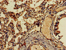 Immunohistochemistry of paraffin-embedded human lung tissue using CSB-PA08939A0Rb at dilution of 1:100