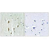 Immunohistochemistry analysis of paraffin-embedded human brain tissue using PAK1/2/3 (Ab-423/402/421) antiobdy.