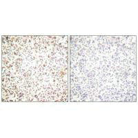 Immunohistochemical analysis of paraffin-embedded human lymph node tissue using OCT-1 antibody.