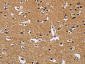 The image on the left is immunohistochemistry of paraffin-embedded Human brain tissue using CSB-PA090179(CBY1 Antibody) at dilution 1/60, on the right is treated with fusion protein. (Original magnification: ×200)