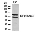 Western blot analysis of extracts from 293 cells using p70 S6 Kinase(Ab-424) Antibody.