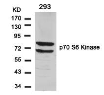 Western blot analysis of extracts from 293 cells using p70 S6 Kinase(Ab-424) Antibody.