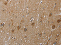 The image on the left is immunohistochemistry of paraffin-embedded Human brain tissue using CSB-PA090550(COX6B2 Antibody) at dilution 1/50, on the right is treated with fusion protein. (Original magnification: ×200)