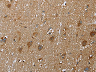 The image on the left is immunohistochemistry of paraffin-embedded Human brain tissue using CSB-PA090550(COX6B2 Antibody) at dilution 1/50, on the right is treated with fusion protein. (Original magnification: ×200)
