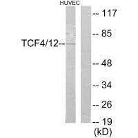 Western blot analysis of extracts from HUVEC cells, using TCF4/12 antibody.
