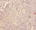 Immunohistochemistry of paraffin-embedded human kidney tissue using CSB-PA09069A0Rb at dilution of 1:100