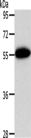 Gel: 10%SDS-PAGE, Lysate: 40 ug, Lane: Human liver cancer tissue, Primary antibody: CSB-PA090852(AGT Antibody) at dilution 1/650, Secondary antibody: Goat anti rabbit IgG at 1/8000 dilution, Exposure time: 5 minutes