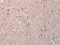 The image on the left is immunohistochemistry of paraffin-embedded Human brain tissue using CSB-PA090961(AKT2 Antibody) at dilution 1/70, on the right is treated with synthetic peptide. (Original magnification: ×200)