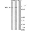 Western blot analysis of extracts from HeLa cells and HUVEC cells, using MKL1 antibody.