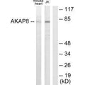 Western blot analysis of extracts from mouse heart cells and Jurkat cells, using AKAP8 antibody.