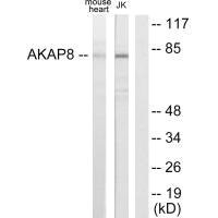Western blot analysis of extracts from mouse heart cells and Jurkat cells, using AKAP8 antibody.