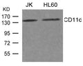 Western blot analysis of extract from JK, HL-60 cells using CD11c Antibody
