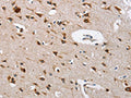 The image on the left is immunohistochemistry of paraffin-embedded Human brain tissue using CSB-PA092272(CTSL Antibody) at dilution 1/40, on the right is treated with fusion protein. (Original magnification: ×200)