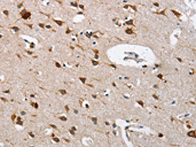 The image on the left is immunohistochemistry of paraffin-embedded Human brain tissue using CSB-PA092272(CTSL Antibody) at dilution 1/40, on the right is treated with fusion protein. (Original magnification: ×200)