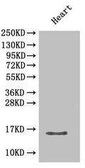 Western Blot
Positive WB detected in: Mouse heart tissue
All lanes: Cxcl5 antibody at 2µg/ml
Secondary
Goat polyclonal to rabbit IgG at 1/50000 dilution
Predicted band size: 15 kDa
Observed band size: 15 kDa