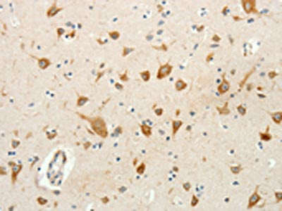 The image on the left is immunohistochemistry of paraffin-embedded Human brain tissue using CSB-PA092850(RPAP3 Antibody) at dilution 1/20, on the right is treated with fusion protein. (Original magnification: ×200)