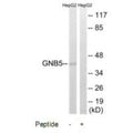 Western blot analysis of extracts from HepG2 cells, using GNB5 antibody.