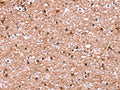 The image on the left is immunohistochemistry of paraffin-embedded Human brain tissue using CSB-PA093138(ADM2 Antibody) at dilution 1/40, on the right is treated with synthetic peptide. (Original magnification: ×200)