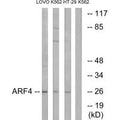 Western blot analysis of extracts from LOVO cells, K562 cells and HT-29 cells, using ARF4 antibody.