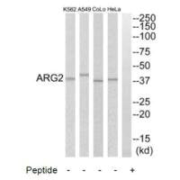 Western blot analysis of extracts from HeLa cells, A549 cells, COLO205 cells and K562 cells, using ARG2 antibody.