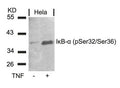 Western blot analysis of extracts from Hela cells untreated or treated with TNF using IkB-a(Phospho-Ser32/Ser36) Antibody.