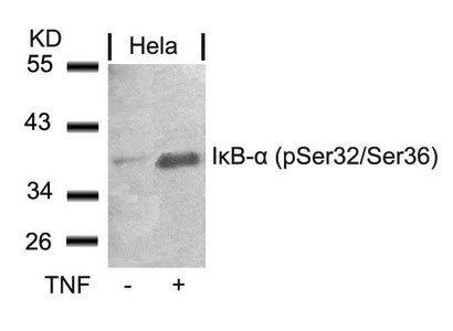 Western blot analysis of extracts from Hela cells untreated or treated with TNF using IkB-a(Phospho-Ser32/Ser36) Antibody.