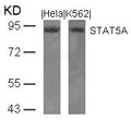Western blot analysis of extracts from Hela and K562 cells using STAT5A(Ab-694) Antibody.
