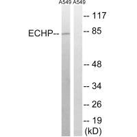 Western blot analysis of extracts from A549 cells, using EHHADH antibody.