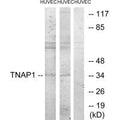 Western blot analysis of extracts from HUVEC cells treated with PMA (125ng/ml, 30mins), and HUVEC cells treated with serum (20%, 30mins), using TNAP1 antibody.