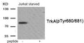 Western blot analysis of extracts from Jurkat cells treated with starved using Phospho-Trk A (Tyr680/Tyr681) antibody.The lane on the right is treated with the antigen-specific peptide.