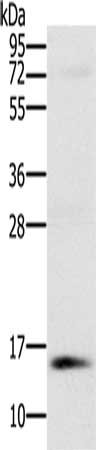 Gel: 10%SDS-PAGE, Lysate: 40 ug, Lane: Human normal kidney tissue, Primary antibody: CSB-PA095960(NDUFA6 Antibody) at dilution 1/250, Secondary antibody: Goat anti rabbit IgG at 1/8000 dilution, Exposure time: 1 minute