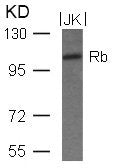 Western blot analysis of extracts from JK cells using Rb(Ab-780) Antibody.