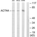 Western blot analysis of extracts from 293 cells, HeLa cells and A549 cells, using ACTN4 antibody.