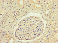Immunohistochemistry of paraffin-embedded human kidney tissue using CSB-PA09689A0Rb at dilution of 1:100