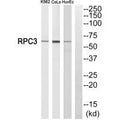 Western blot analysis of extracts from K562 cells, CoLo205 cells and HuvEc cells, using RPC3 antibody.