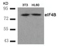 Western blot analysis of extracts from 3T3 and HL60 cells using eIF4B(Ab-422) Antibody.