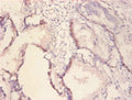 Immunohistochemistry of paraffin-embedded human prostate tissue using CSB-PA09759A0Rb at dilution of 1:100