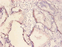 Immunohistochemistry of paraffin-embedded human prostate tissue using CSB-PA09759A0Rb at dilution of 1:100