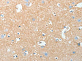 The image on the left is immunohistochemistry of paraffin-embedded Human brain tissue using CSB-PA097902(AKAP7 Antibody) at dilution 1/15, on the right is treated with fusion protein. (Original magnification: ×200)