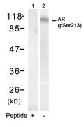 Western blot analysis of extracts from DU145 cells using Androgen Receptor(Phospho-Ser213) Antibody(Lane 2) and the same antibody preincubated with blocking peptide(Lane1).