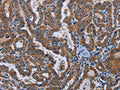 LYN Antibody – Figure 1 of 2