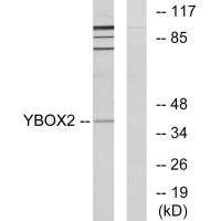 Western blot analysis of extracts from COLO205 cells, using YBOX2 antibody.