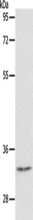Gel: 10%SDS-PAGE, Lysate: 40 ug, Lane: Mouse stomach tissue, Primary antibody: CSB-PA098112(CASP6 Antibody) at dilution 1/50, Secondary antibody: Goat anti rabbit IgG at 1/8000 dilution, Exposure time: 30 seconds