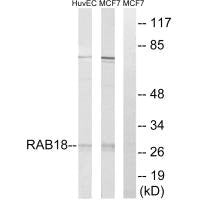 Western blot analysis of extracts from HuvEc cells and MCF-7 cells, using RAB18 antibody.