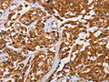 CRYAB Antibody – Figure 1 of 2