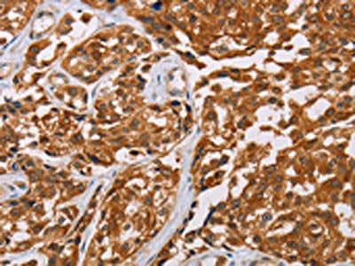 CRYAB Antibody – Figure 1 of 2
