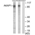Western blot analysis of extracts from HUVEC cells and COLO cells, using AKAP1 antibody.