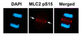 Immunofluorescence staining of methanol-fixed U87 cells using MLC2 (Phospho-Ser15) Antibody.